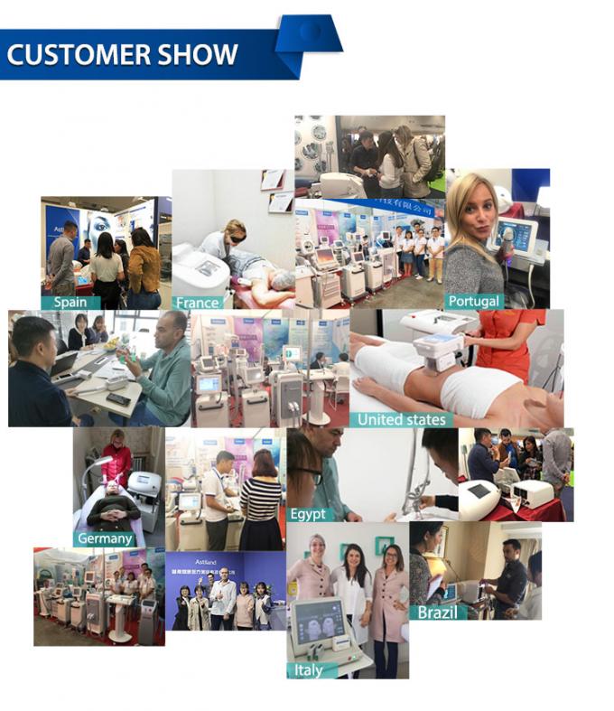 800w آلة العلاج بالتبريد الوجه -20c آلة تبريد الجلد Zimmer العلاج بالتبريد 15