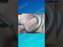 الليزر المضاد للشيخوخة مقابل الليزر المضاد للثاني أكسيد الكربون أي علاج ضد الشيخوخة تفضله؟