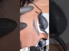 ليزر Nd Yag لإزالة الوشم من الحاجب #ndyaglaser #tattooremovallaser #beautymachine #laserclinic